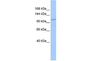 IFT122 antibody used at 1 ug/ml to detect target protein.