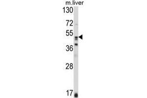 Western blot analysis of GSS Antibody (C-term) in mouse liver tissue lysates (35 µg/lane). (Glutathione Synthetase 抗体  (C-Term))