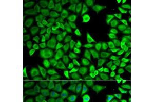 Immunofluorescence analysis of HeLa cells using LTA4H Polyclonal Antibody (LTA4H 抗体)