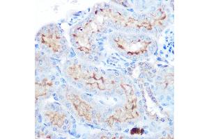 Immunohistochemistry of paraffin-embedded human esophageal using TNFSF13B Rabbit pAb (ABIN6127582, ABIN6149343, ABIN6149344 and ABIN6221563) at dilution of 1:100 (40x lens). (BAFF 抗体  (AA 76-285))