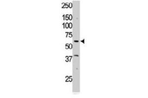 The RYK polyclonal antibody  is used in Western blot to detect RYK in Jurkat cell lysate. (RYK 抗体  (AA 150-200))