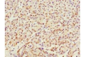 Immunohistochemistry of paraffin-embedded human pancreatic tissue using ABIN7167513 at dilution of 1:100 (PTPRO 抗体  (AA 30-300))
