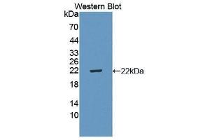 Western Blotting (WB) image for anti-Interleukin 5 Receptor, alpha (IL5RA) (AA 41-203) antibody (ABIN3206508) (IL5RA 抗体  (AA 41-203))