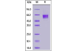 SDS-PAGE (SDS) image for Interleukin 3 Receptor, alpha (IL3RA) (AA 19-305) (Active) protein (His tag,AVI tag,Biotin) (ABIN6973119)