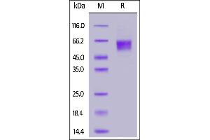 Biotinylated Human IL-3 R alpha, His,Avitag on  under reducing (R) condition. (IL3RA Protein (AA 19-305) (His tag,AVI tag,Biotin))
