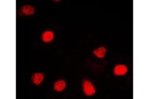Immunofluorescent analysis of ZNF187 staining in HL60 cells. (ZNF187 抗体  (Center))