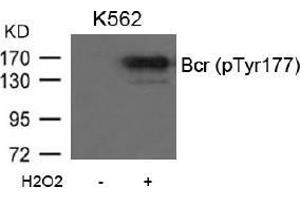 Image no. 2 for anti-Breakpoint Cluster Region (BCR) (pTyr177) antibody (ABIN196938) (BCR 抗体  (pTyr177))