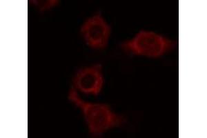 Immunofluorescence (fixed cells) (IF/ICC) image for anti-ATPase, H+ Transporting, Lysosomal Accessory Protein 2 (ATP6AP2) (Internal Region) antibody (ABIN6257458)