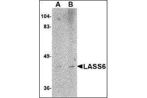 Western blot analysis of LASS6 in rat brain tissue lysate AP30493PU-N at (A) 1 and (B) 2 μg/ml. (CERS6 抗体  (N-Term))