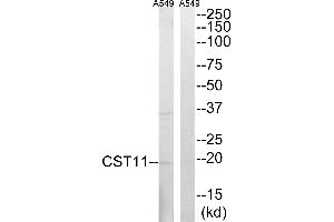 Western blot analysis of extracts from A549 cells, using CST11 antibody. (CST11 抗体)