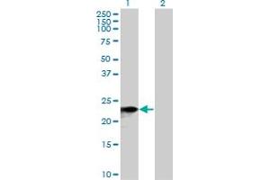 Western Blot analysis of SNX10 expression in transfected 293T cell line by SNX10 MaxPab polyclonal antibody.
