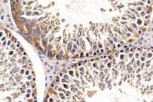 Immunohistochemistry analysis of paraffin-embedded Rat testis using ACE (ABIN7073050) at dilution of 1: 500 (Angiotensin Converting Enzyme 1 抗体)