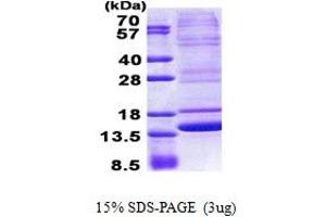 SDS-PAGE (SDS) image for Neuromedin B (AA 25-121) protein (His tag) (ABIN5853037) (Neuromedin B Protein (AA 25-121) (His tag))