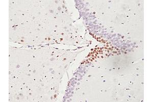 Formalin-fixed and paraffin embedded rat brain labeled with Anti-ATF6 Polyclonal Antibody, unconjugated (ABIN732293) followed by incubation with conjugated secondary antibody and DAB staining (ATF6 抗体  (AA 301-400))