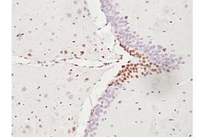 Formalin-fixed and paraffin embedded rat brain labeled with Anti-ATF6 Polyclonal Antibody, unconjugated (ABIN732293) followed by incubation with conjugated secondary antibody and DAB staining (ATF6 抗体  (AA 301-400))