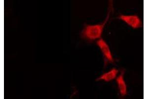 Immunofluorescence (fixed cells) (IF/ICC) image for anti-Amyloid beta (A4) Precursor Protein-Binding, Family A, Member 3 (APBA3) (N-Term) antibody (ABIN6258599)