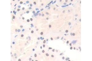 Used in DAB staining on fromalin fixed paraffin- embedded Kidney tissue (Protein Red (IK) (AA 1-192) 抗体)