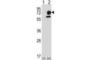 Western Blotting (WB) image for anti-Inositol-Trisphosphate 3-Kinase B (ITPKB) antibody (ABIN5024070) (ITPKB 抗体)