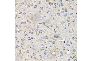 Immunohistochemistry of paraffin-embedded rat brain using MAP1LC3B antibody (ABIN5998170) at dilution of 1/100 (40x lens).