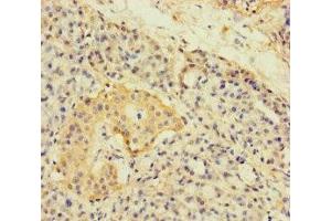 Immunohistochemistry of paraffin-embedded human pancreatic tissue using ABIN7143774 at dilution of 1:100 (A4GNT 抗体  (AA 26-340))