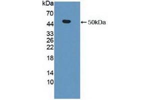 Detection of Recombinant MMP19, Human using Polyclonal Antibody to Matrix Metalloproteinase 19 (MMP19) (MMP19 抗体  (AA 98-508))