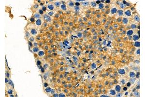 ABIN6261469 and ABIN6278061 at 1/100 staining Mouse testis tissue by IHC-P. (EHD1 抗体  (C-Term))