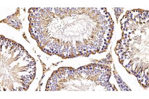 Immunohistochemistry (IHC) image for anti-Peroxiredoxin 2 (PRDX2) (AA 6-164) antibody (ABIN7436132)