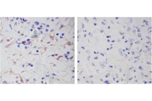 Immunohistochemistry analysis of human spleen tissue slide (Paraffin embedded) using Rabbit Anti-Vimentin Polyclonal Antibody (Left, ABIN398721) and Purified Rabbit IgG (Whole molecule) Control (Right, ABIN398653) (Vimentin 抗体  (AA 400-500))