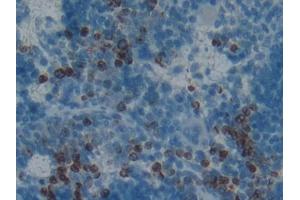 DAB staining on IHC-P; Samples: Rat Spleen Tissue (PGLYRP1 抗体  (AA 18-183))