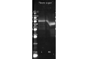 Goat anti Plasminogen antibody  was used to detect Plasminogen under reducing (R) and non-reducing (NR) conditions.