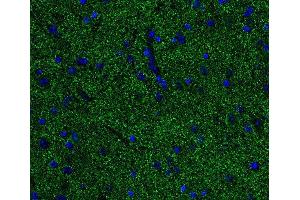 Indirect immunostaining of PFA fixed paraffin embedded mouse spinal cord section (dilution 1 : 500; green). (Alpha, beta Synuclein (AA 1-140) 抗体)