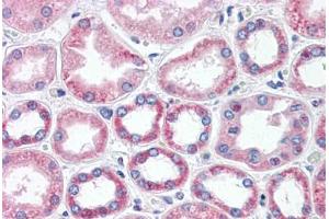Human Kidney (formalin-fixed, paraffin-embedded) stained with BAI3 antibody ABIN462085 followed by biotinylated goat anti-rabbit IgG secondary antibody ABIN481713, alkaline phosphatase-streptavidin and chromogen. (BAI3 抗体  (AA 1506-1522))