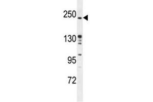 Western Blotting (WB) image for anti-RPTOR Independent Companion of mTOR, Complex 2 (RICTOR) (AA 805-835) antibody (ABIN3028993)