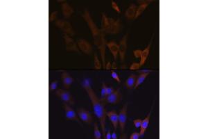 Immunofluorescence analysis of NIH-3T3 cells using  Rabbit mAb (ABIN7265739) at dilution of 1:100 (40x lens). (ABCE1 抗体)