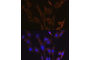 Immunofluorescence analysis of NIH-3T3 cells using  Rabbit mAb (ABIN7265739) at dilution of 1:100 (40x lens). (ABCE1 抗体)