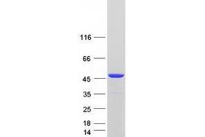 Western Blotting (WB) image for Cysteine-S-conjugate beta-Lyase (CCBL1) (Transcript Variant 2) protein (Myc-DYKDDDDK Tag) (ABIN2713272)