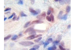 Image no. 1 for anti-Melanoma Inhibitory Activity (MIA) antibody (ABIN464851) (MIA 抗体)