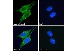 (ABIN190816) Immunofluorescence analysis of paraformaldehyde fixed NIH3T3 cells, permeabilized with 0. (PLIN3 抗体  (Internal Region))