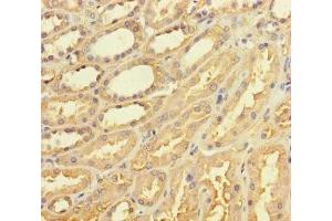 Immunohistochemistry of paraffin-embedded human kidney tissue using ABIN7171552 at dilution of 1:100 (TAS2R42 抗体  (AA 149-187))
