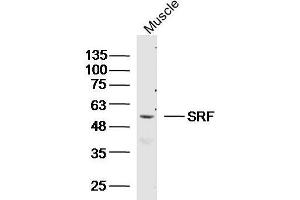 Mouse muscle lysates probed with SRF Polyclonal Antibody, unconjugated  at 1:300 overnight at 4°C followed by a conjugated secondary antibody at 1:10000 for 90 minutes at 37°C. (SRF 抗体  (AA 101-250))