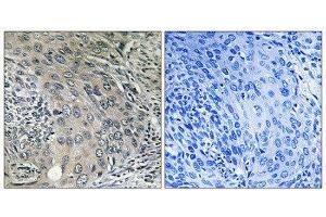 Immunohistochemistry (IHC) image for anti-Coatomer Protein Complex, Subunit zeta 1 (COPZ1) (N-Term) antibody (ABIN1851138) (COPZ1 抗体  (N-Term))