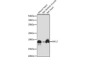 Western blot analysis of extracts of various cell lines, using MYL2 Rabbit mAb (ABIN7268761) at 1:1000 dilution. (MYL2 抗体)