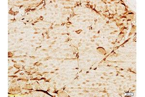 Formalin-fixed and paraffin embedded mouse liver tissue labeled with Anti-TIMP-3 Polyclonal Antibody , Unconjugated at 1:100, followed by conjugation to the secondary antibody and DAB staining (TIMP3 抗体  (AA 151-211))