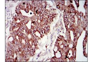 Immunohistochemistry (IHC) image for anti-Phosphoinositide 3 Kinase, p85 alpha (PI3K p85a) (AA 159-388) antibody (ABIN1844692) (PIK3R1 抗体  (AA 159-388))