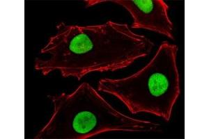 Fluorescent image of HeLa cells stained with SUMO-2 antibody at 1:25 dilution. (SUMO2 抗体)