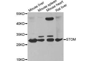 Western blot analysis of extracts of various cell lines, using STOM antibody (ABIN5973779) at 1/1000 dilution. (Stomatin 抗体)