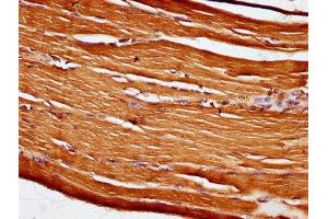 IHC image of ABIN7162115 diluted at 1:100 and staining in paraffin-embedded human skeletal muscle tissue performed on a Leica BondTM system. (Obscurin 抗体  (AA 1621-1712))