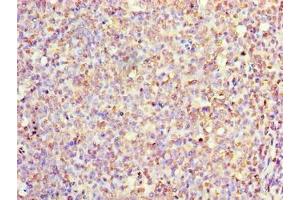 Immunohistochemistry of paraffin-embedded human tonsil tissue using ABIN7156730 at dilution of 1:100 (IL1A 抗体  (AA 1-152))