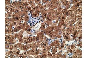 Immunohistochemical staining of paraffin-embedded Human liver tissue using anti-ADH1B mouse monoclonal antibody. (ADH1B 抗体)
