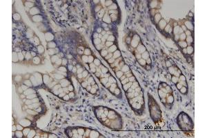 Immunoperoxidase of monoclonal antibody to RARS on formalin-fixed paraffin-embedded human small Intestine. (RARS 抗体  (AA 1-660))